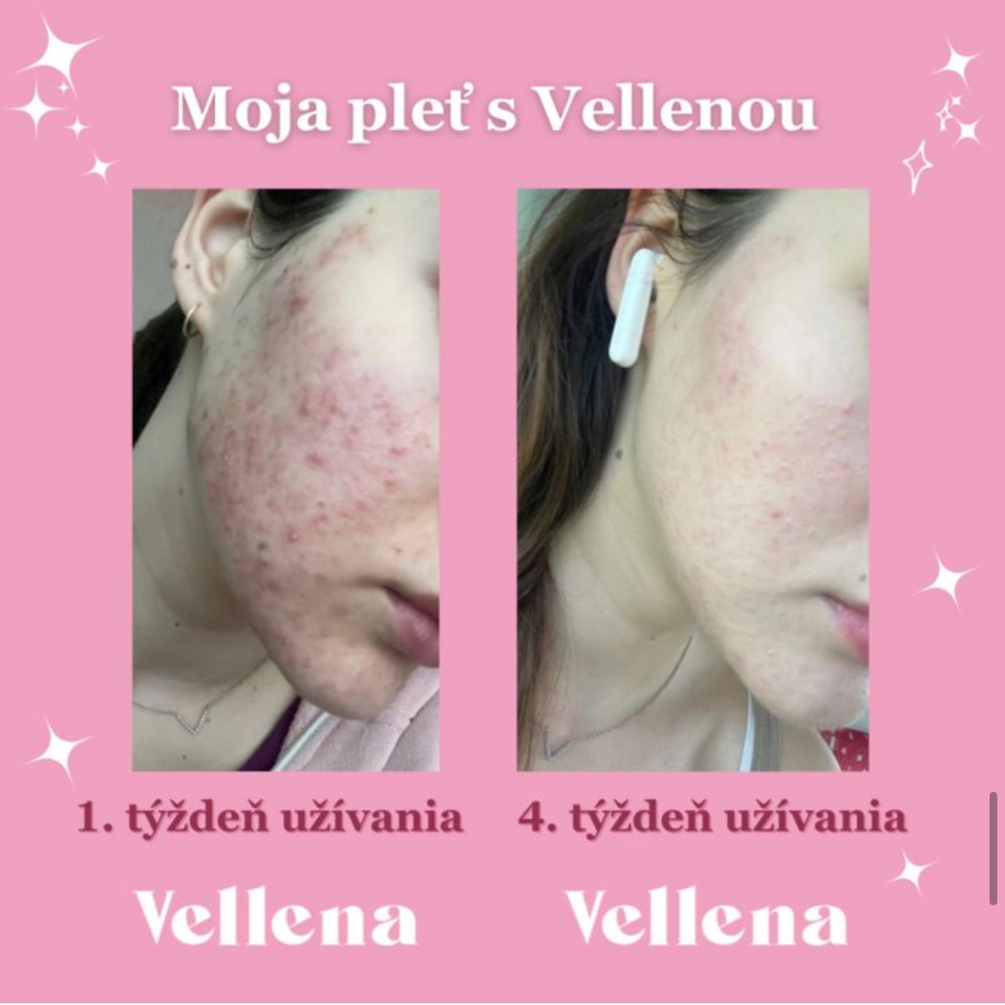 Hormonálne zdravie | nápoj pre ženy 2PACK | Grep