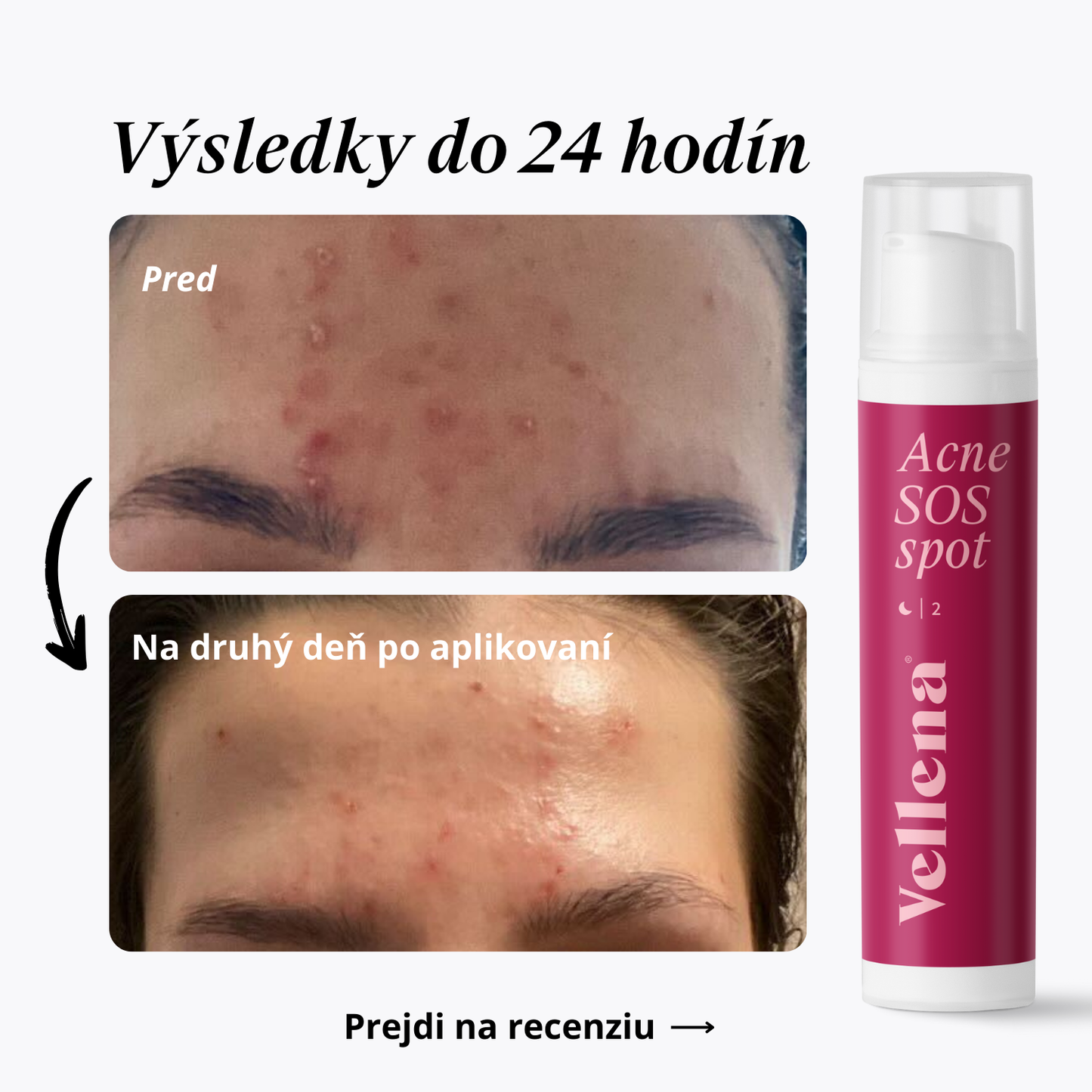 Gél na vyrážky 15ml | Vellena