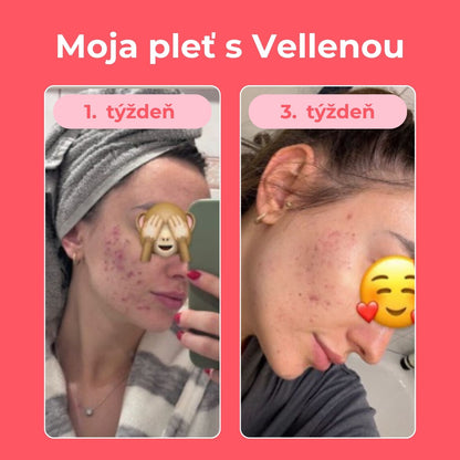 Ženské zdravie | Kapsuly | Vellena