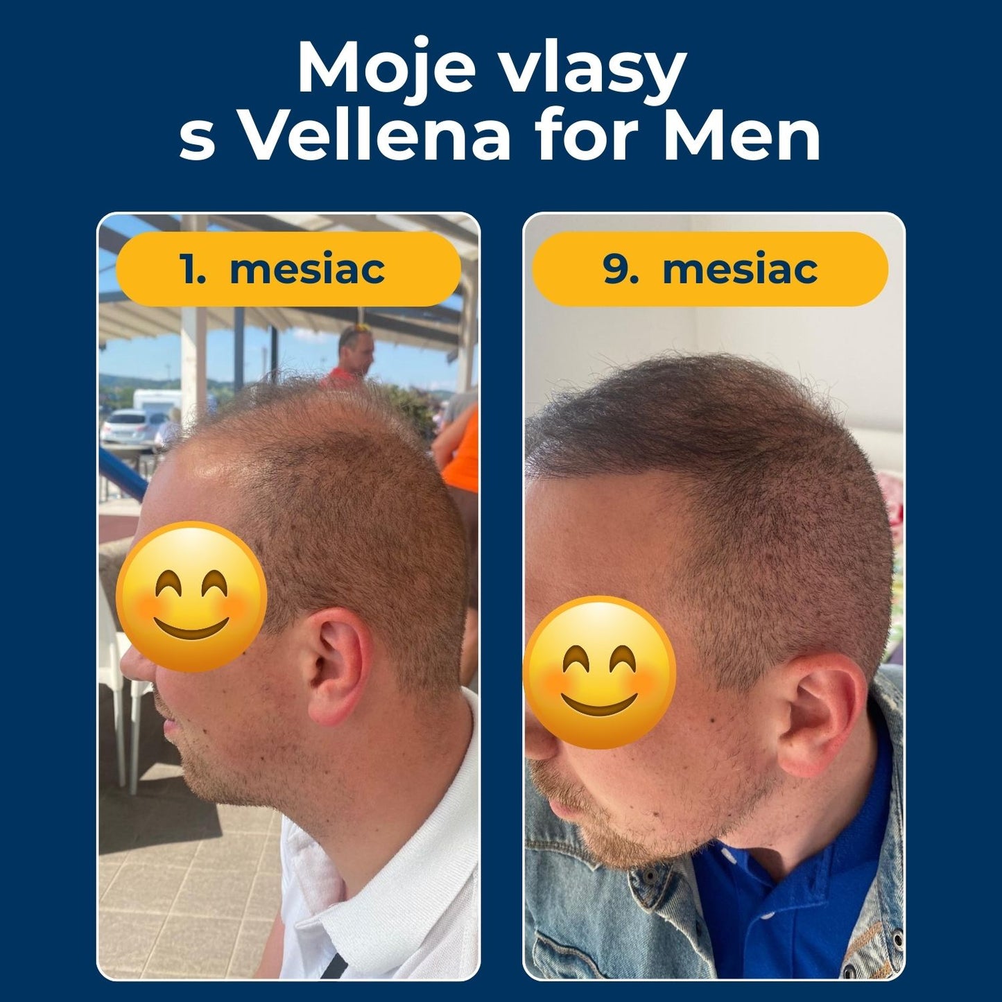 Mužské zdravie | Kapsuly 2PACK | Vellena for Men