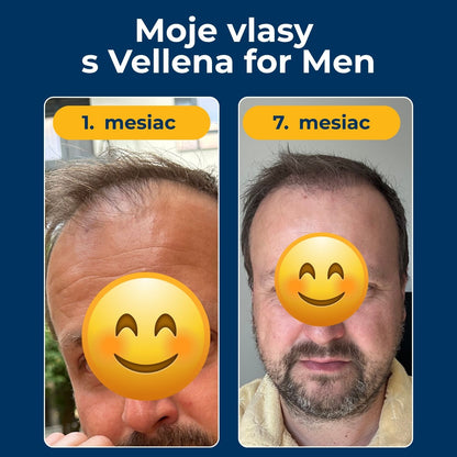 Mužské zdravie | Kapsuly 2PACK | Vellena for Men