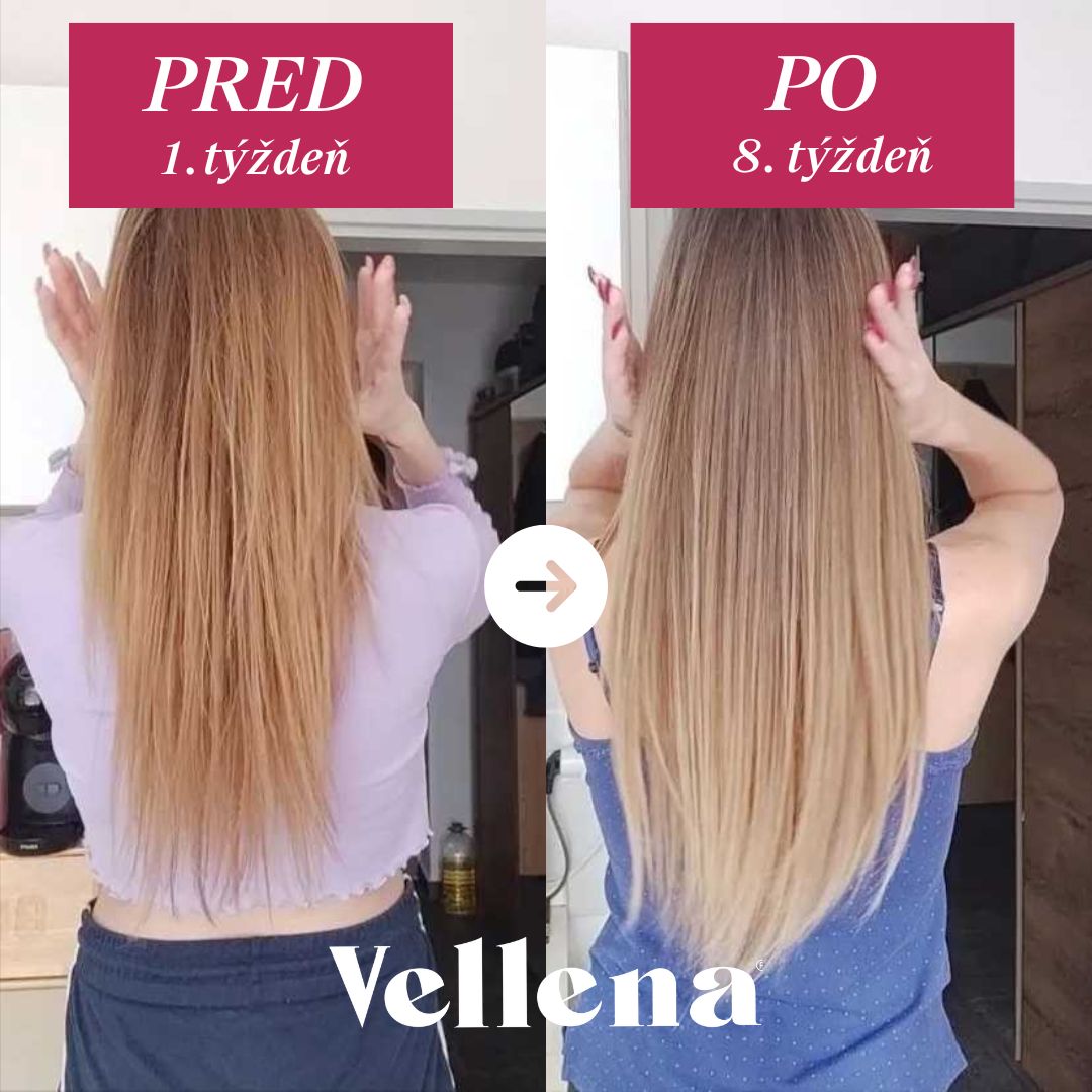 Hormonálne zdravie | nápoj pre ženy 2PACK | Višňa